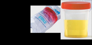 ISOLAB Urine Container with screw cap